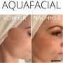 Aqua Facial vor Ort Schulung Inkl. Schulungsunterlagen & Zertifikat
